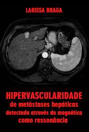   Hipervascularidade de metástases hepáticas, detectada através da ressonância magnética, como indicador de progressão da doença em pacientes com câncer de mam Faculdade de Medicina / Radiologia