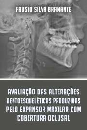   Avaliação das alterações dentoesqueléticas produzidas pelo expansor maxilar com cobertura oclusal seguido do aparelho fixo Faculdade de Odontologia de Bauru / Ortodontia