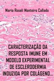   Caracterização da resposta imune em modelo experimental de esclerodermia induzida por colágeno tipo V Faculdade de Medicina / Reumatologia