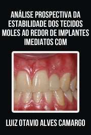   Análise prospectiva da estabilidade dos tecidos moles ao redor de implantes imediatos com restaurações imediatas em incisivos centrais superiores Faculdade de Odontologia / Prótese Dentária